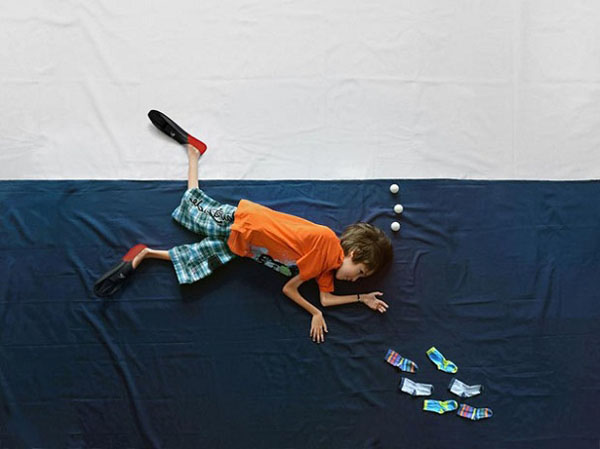 muscular dystrophy photography