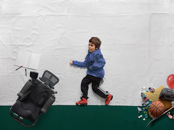 muscular dystrophy photography