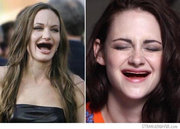 celebrities without teeth