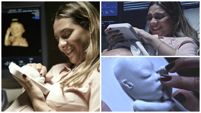 Blind mom gets 3D ultrasound